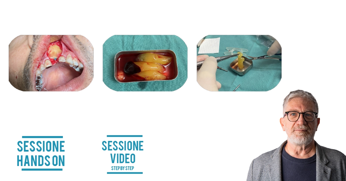 Corso base introduttivo all’utilizzo degli emocomponenti in odontoiatria