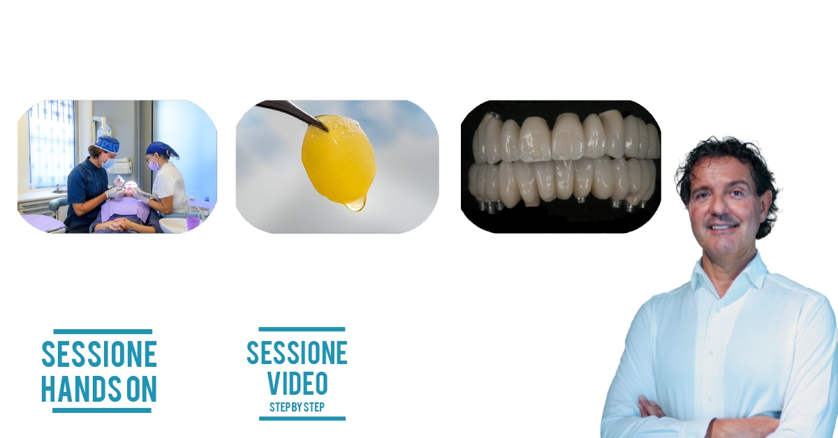 Corso base di Chirurgia Implantare