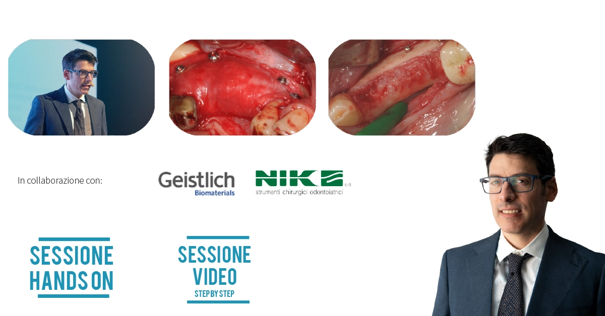 Corso Tecniche chirurgiche e di rigenerazione delle creste atrofiche