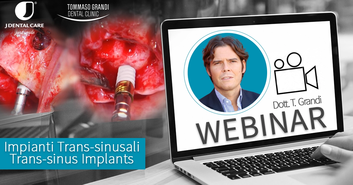 Webinar Impianti Trans-sinusali /Trans-sinus Implants