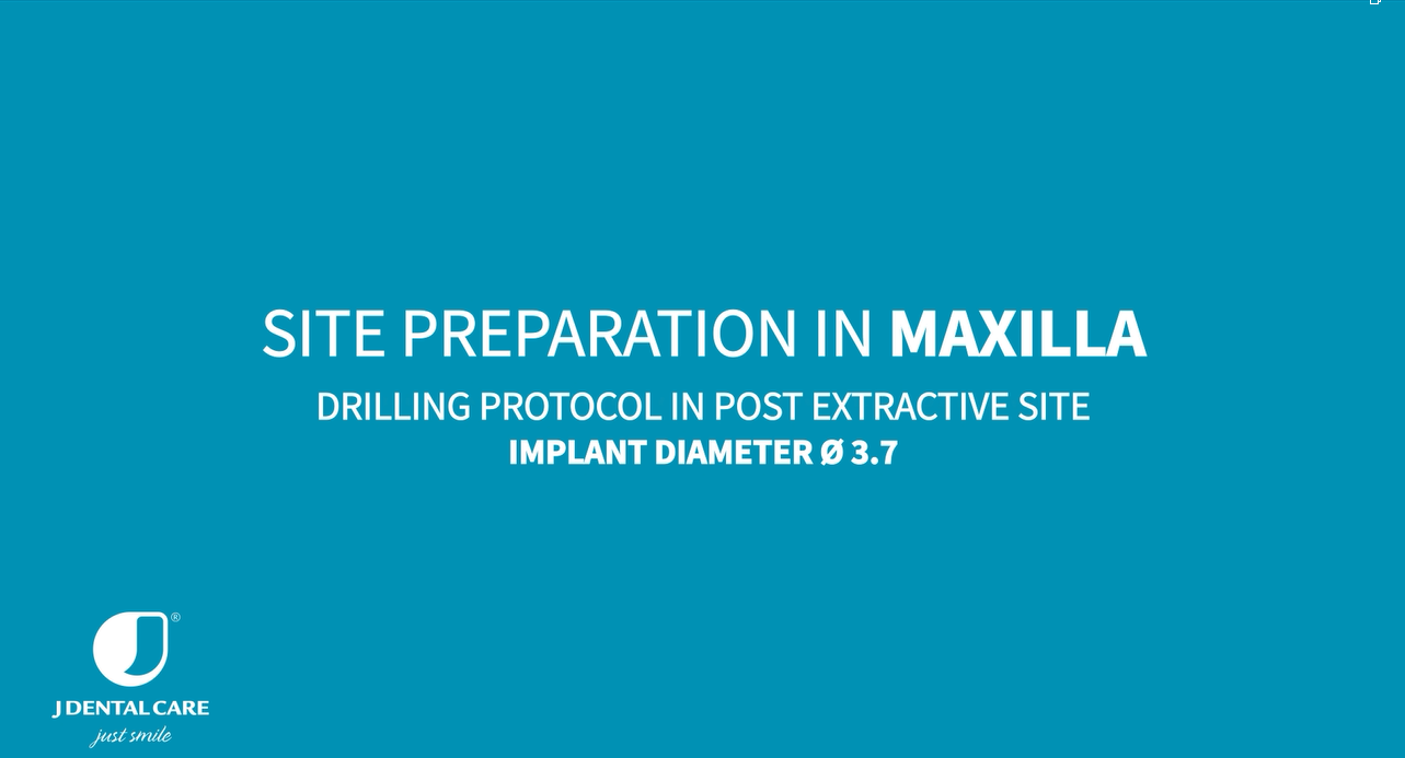 Implant Ø3.7 L13 – site preparation in maxilla and mandible