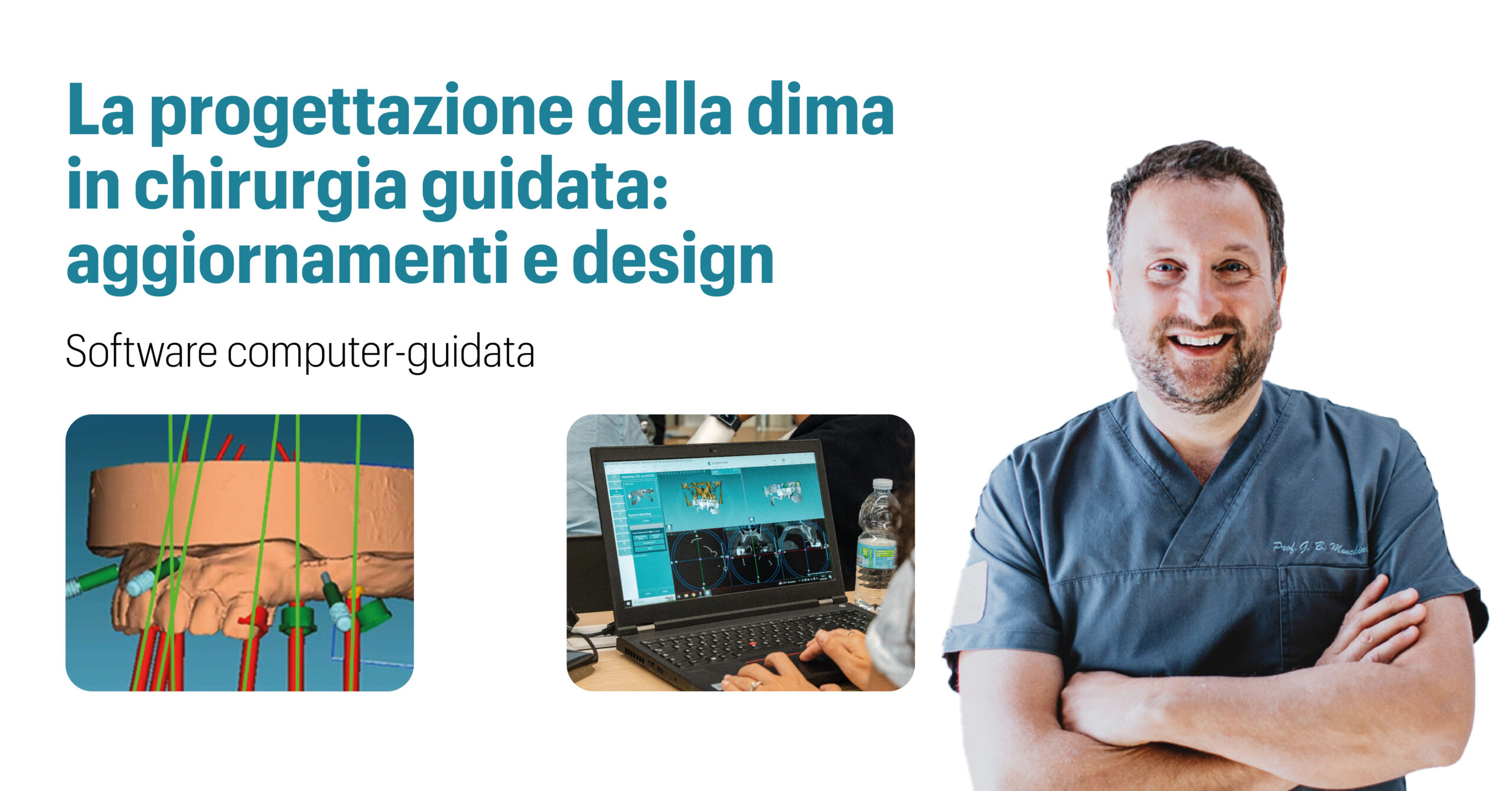 La progettazione della dima in chirurgia guidata: aggiornamenti e design