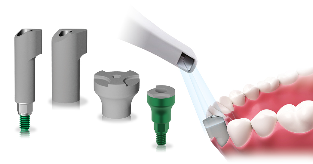 Scan body and intraoral scanners: what they are and how they work