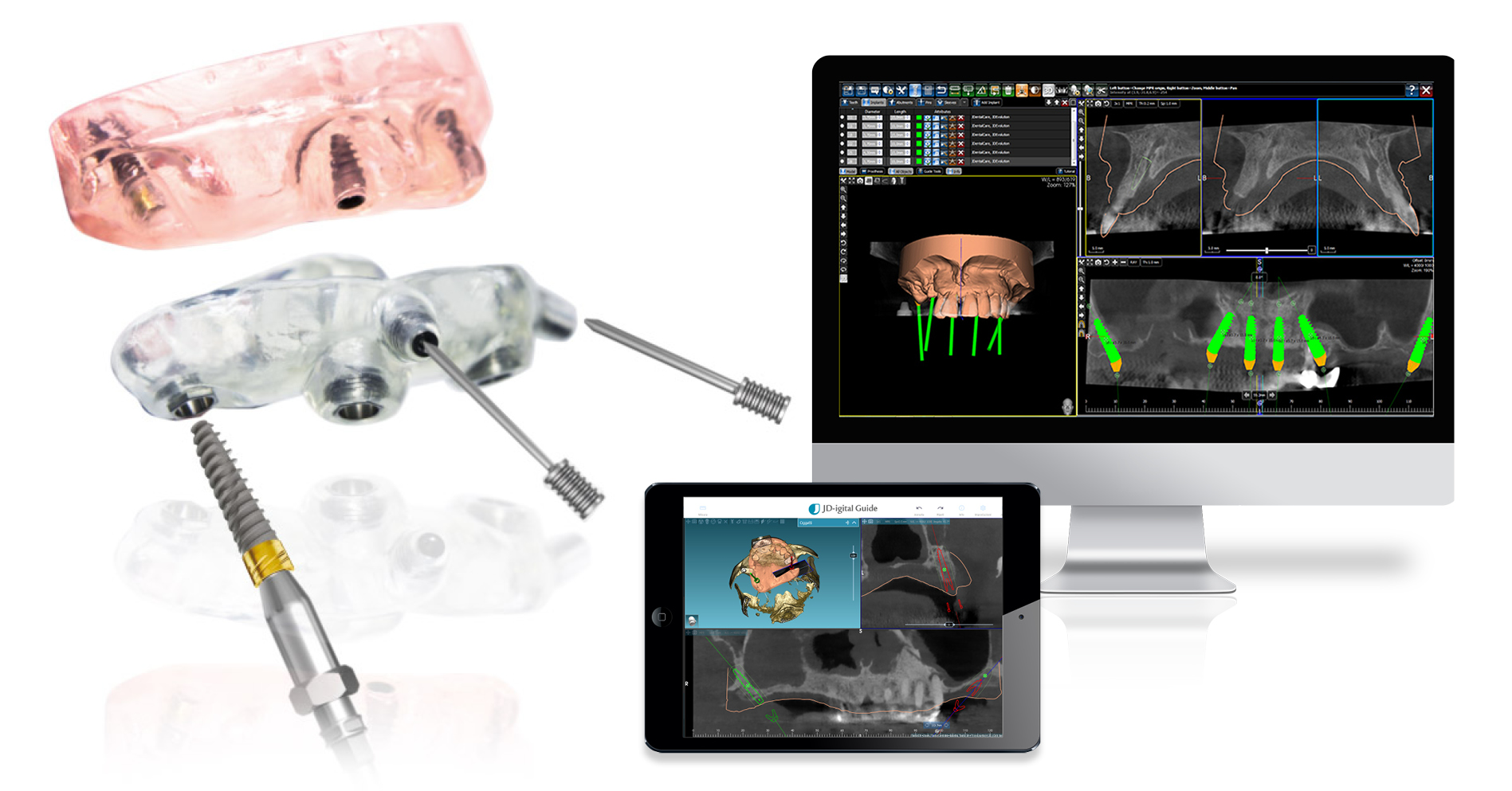 The surgical guide in the computer guided surgery