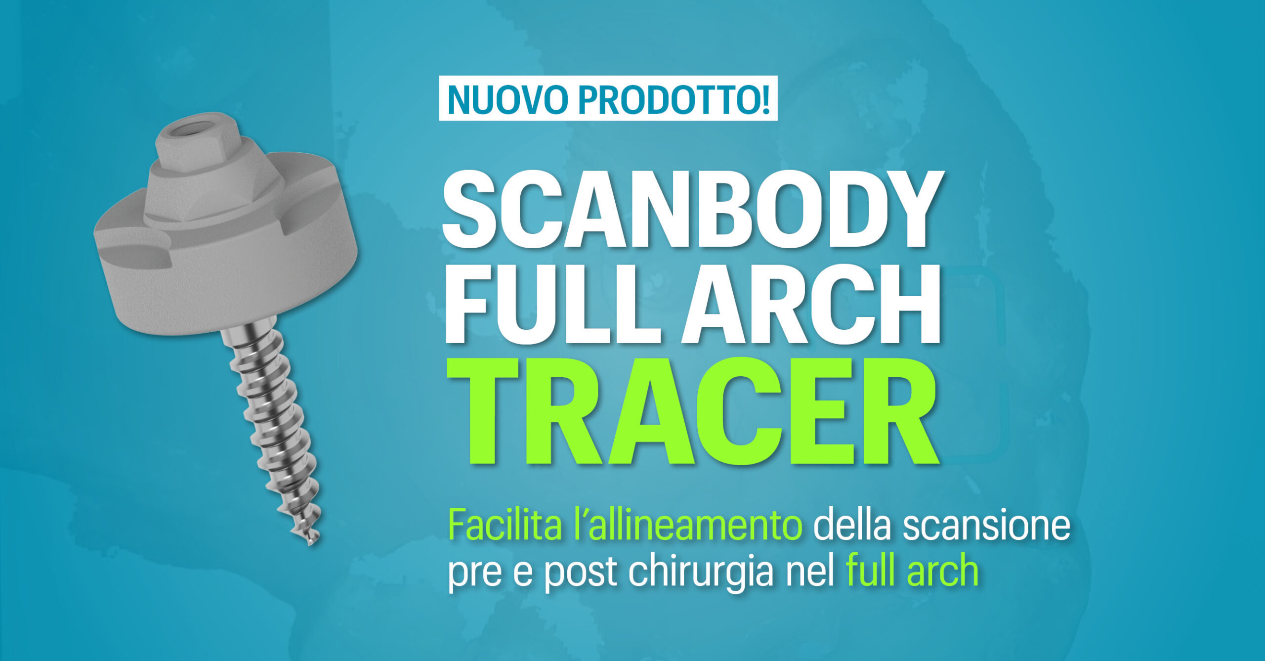 Scanbody Full Arch Tracer