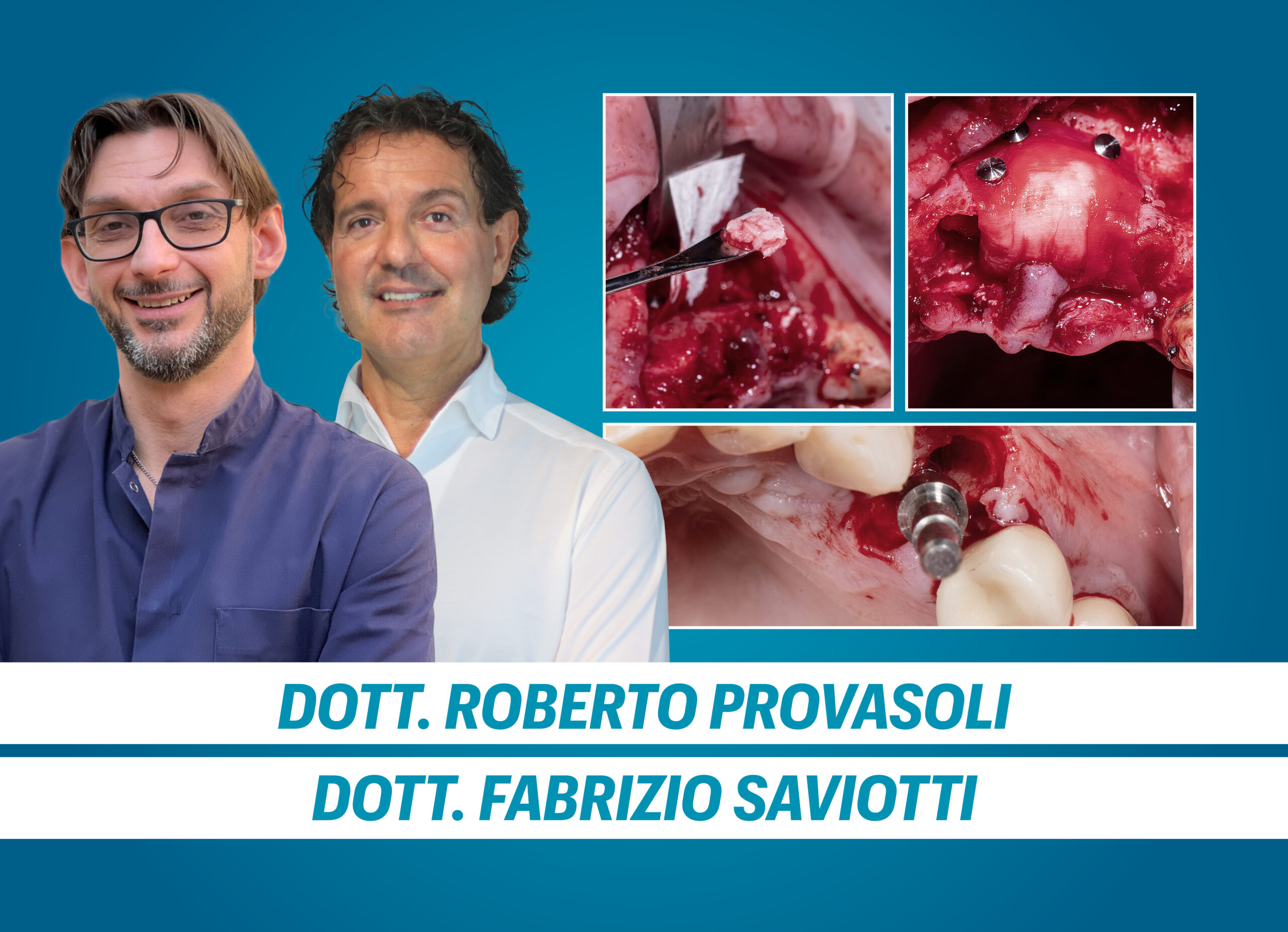 CORSO DI IMPLANTOLOGIA AVANZATA E TECNICHE RIGENERATIVE DI BASE