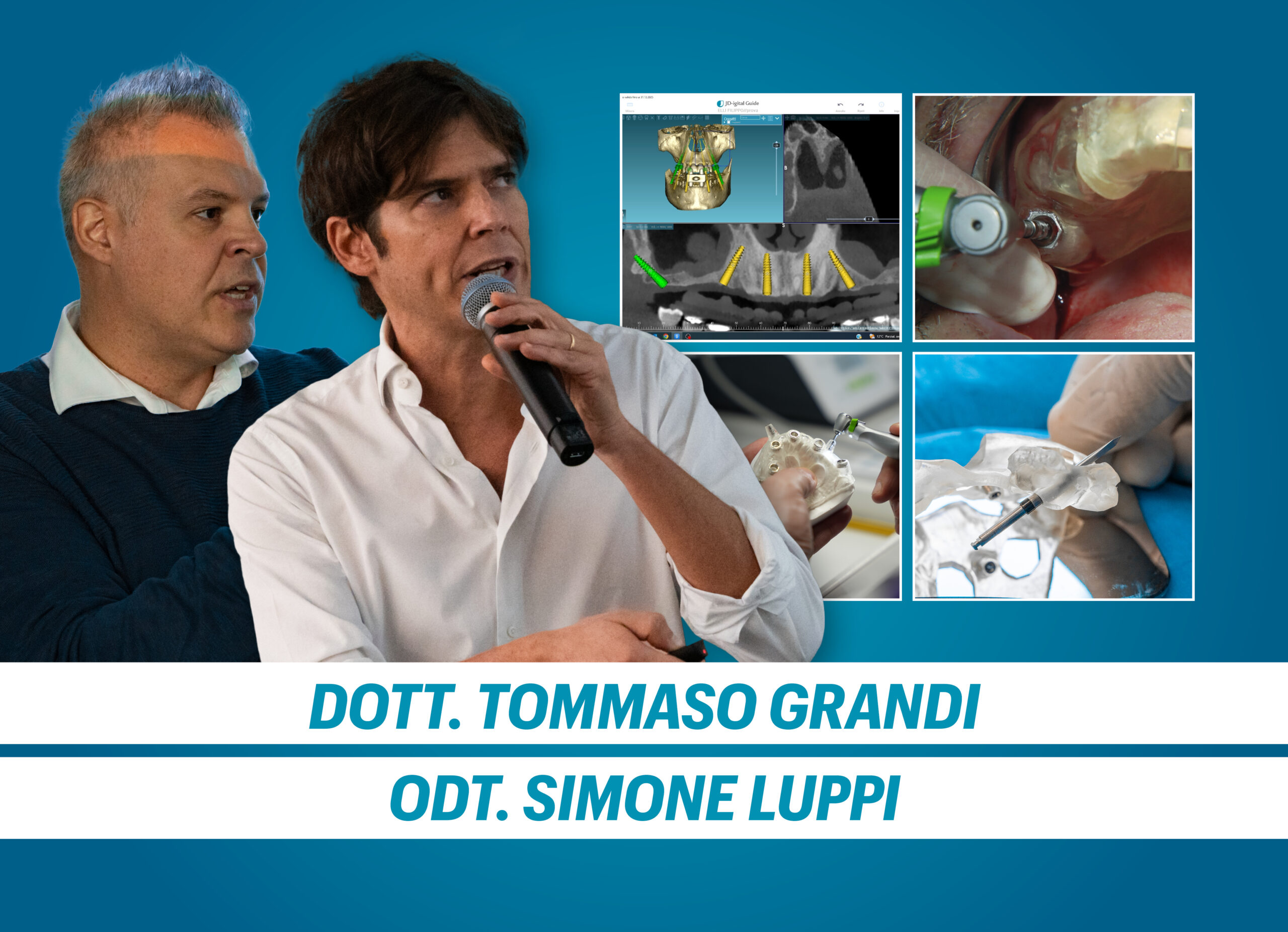CHIRURGIA IMPLANTARE GUIDATA CON IL PROTOCOLLO JD