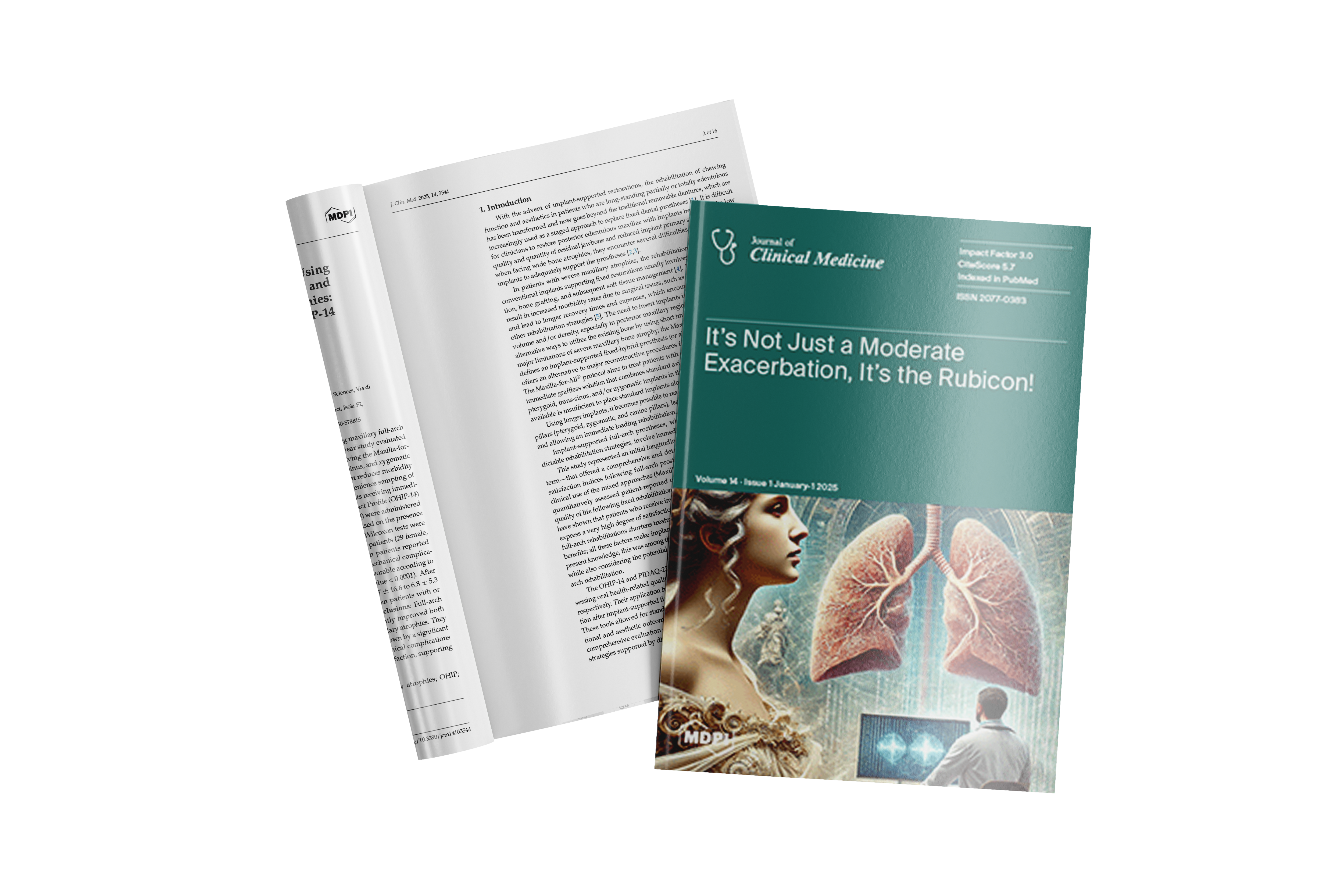 Psychosocial Impact of Maxilla-For-All® Treatment Using Standard and Long Implants (Pterygoid, Trans-Sinus and Zygomatic) on Patients with Severe Maxillary Atrophies: A 1-Year Prospective Study with PIDAQ-23 and OHIP-14